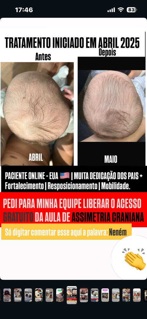 Resultado de tratamento iniciado em Abril 2025