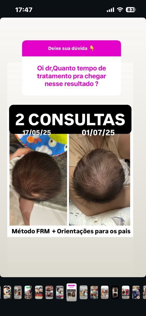 Resultado de 2 consultas