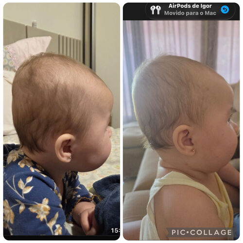 Antes e depois - evolução do tratamento